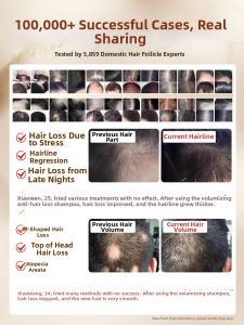 RUYI | Anti-Hair Loss Strengthening Ginger and Chinese Arborvitae Shampoo