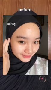 REJUVE SERUM KF SKIN ORI