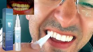 EELHOE | EELHOE Damaged Gum Repair Care Gel Deep Cleaning Effectively Removes Yellow Teeth Stains Tartar Fresh Breath Teeth Cleaning Gel