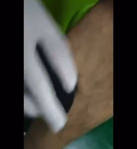 Epilator Alat Penghilang Bulu Ketiak Kaki / Alat Epilator Hair Remover Pembersih Kulit Mati