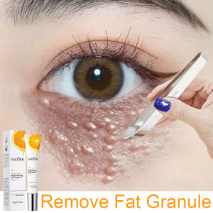 Vitamin C Eye Cream for Dark Circles Anti Aging Remove Fine Lines Fat Particles维生素C眼霜20g