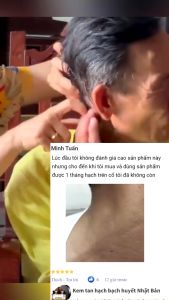 Kem Tan u hạch cổ truyền Thải độc tố Giảm Sưng Giải phóng bạch huyết