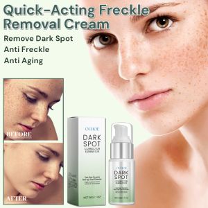 Freckle Removal Cream Dark Spot Remover Cream Tone Whitening Anti Freckle Cream Moisturizing Brighten Anti Aging Cream