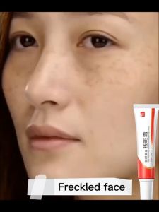 🔥B.two👍 100% Effective Original Melasma Cream Pekas Remover Collagen Pekas Remover Cream Skin Whitening Moisturizer Whitening Freckle Cream Remover Facial Moisturizers