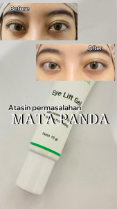 BIO HERBAL EYE LIFT GEL BPOM | PENGHILANG KANTONG MATA EYE BAG