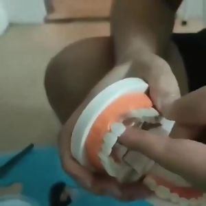 Temporary dentures with solid dental glue for instant perfect filling of defects cos denture 30ml