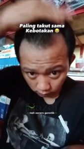 Penumbuh Rambut Botak M Cepat - Flo Hair Tonic Original Resmi BPOM Tonic Rambut Dengan Bahan Alami Perawatan Rambut Rontok Indonesia - Lazada