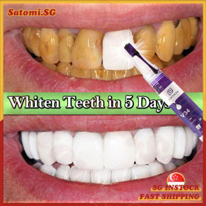 💄SG Stock💄 v34 Teeth whitening pen / Teeth whitening gel / Teeth stain remover / Plaque remover / Tooth cleaner tartar remover / 牙齿美白笔