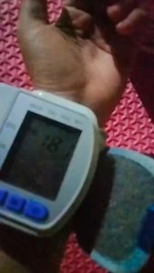 Tensi Darah Digital Tensimeter Pengukur Cek Tekanan Darah Otomatis Lengan Tangan Omicron