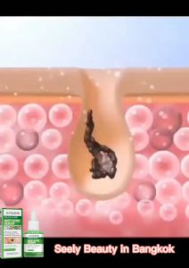 1 แถม 1 อ่อนโยน 30ml Jayusing เซรั่มแต้มสิว ซ่อมแซมรอยสิวลอกสิว ครีมลดรอยสิว เจลแต้มสิว เซรั่มลดสิว