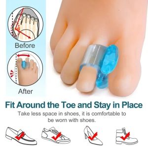 SRIEI 2PCS Protective Toes Separator Suitable Bunion Corrector Material Soft Gel Straightener Spacers Stretchers Foot Care Tools