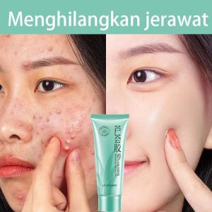 Pelembab Aloe Vera Gel Acne Whitening Sunburn Repair Cream 40g