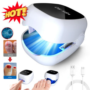 Nail Fungus Laser LED Light Device Fungal Nail Treatment Anti-Equipment Effectively Remove Fungal Toenail Nail Fungal Infection