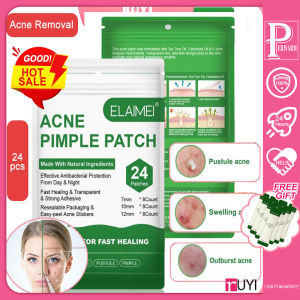 72PCS Invisible Acne Removal Pimple Patch Treatment Pimple acne Concealer Face Spot Scar Care Treatment Stickers (S2A-P4)