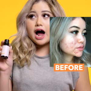 Skinlycious Glow Exfoliant- Removes Blackheads and Acne