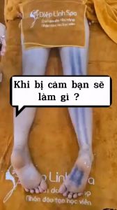 Bọ Cạp Bạc Ta Chuẩn Y Tế - Trục Hàn Đánh Gió Giải Cảm - Dụng Cụ Diện Chẩn