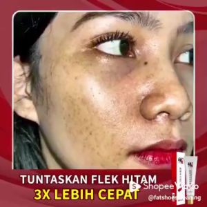 Effective Whitening Freckle Cream 20g Moisturizing Facial Spot Cream Remove Melasma Acne Spot Pigment Melanin