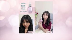 Barcony ยกลัง สุดปัง เซรั่มฟิลเลอร์ หน้าอิ่มฟู ดูเด็ก เกาหลี 5 ชิ้น, 12 ชิ้น, 50 ชิ้น