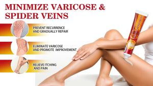 Kem Bôi Suy Giãn Tĩnh Mạch Nội Địa Trung Sumifun Varicose Veins Cream 20gr Chính Hãng - Kem Bôi Tĩnh Mạch Nội Địa Trung Giảm Suy Giãn Tĩnh Mạch Giảm Đau Giảm Sưng Tăng Lưu Thông Máu - Thiên Châu Pharmacy