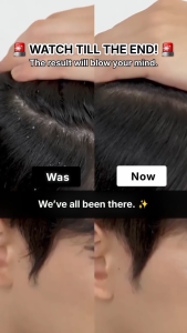 (FORBEAUT OFFICIAL STORE) Dandruff Scalp Brush - COCOMO