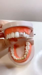 Tooth Repair Kit Temporary Filling Portable Teeth Replacement Tooth Care Accessories Temp Cavity Filler For Women Men s