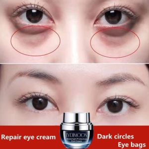 Eye cream  Removing dark circles and eye cream  30g  Removing eye bags  dark under-eye circles  Anti aging  Fade fine lines  Repair eye cream