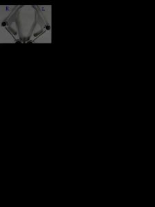 ปีกนกล่าง NISSAN X TRAIL T32 ปี2014-2022 ปีกนกล่างเอ็กซ์เทรล