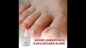 JIANLAB NAIL FIT SERUM buat kuku rusak busuk original produk