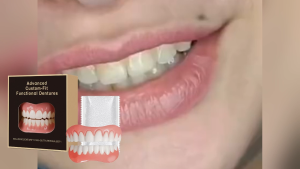 2Pc Upper/Lower Perfect Smile Veneers – Instant Cosmetic Tooth Protector with Fixed Snaps One Size Fits Everyone Snap-On Teeth Cover for Flawless Smile Reusable & Easy to Use