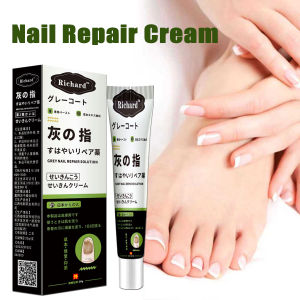 EELHOE | Nail Fungus Smoothing Cream Anti Fungal Foot Toe Nails Alleviate Gel Anti-Infection Onychomycosis Paronychia Care Ointment