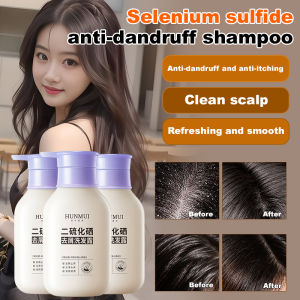 Selenium Disulfide Shampoo Oil Control Fluffy Hair Follicle Anti-Dandruff Itching Anti-Mite Inflammation Shampoo Cream for Men and Women Official Authentic