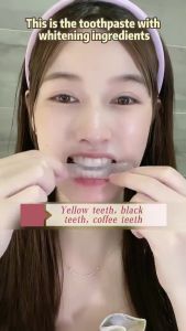 Teeth whitening strips Clean Big yellow tooth Stubborn stains Tea stains Complete whitening shining teeth in 7 days Teeth Whitening TARTAR and TARTAR Removal Yellow Cleaning Eliminate TARTAR Protect Gums gel Teeth whitening strip