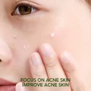 Kem mụn AKINO- Gel giảm mụn giảm thâm làm mờ vết thâm mụn làm dịu và dưỡng ẩm cho da12g