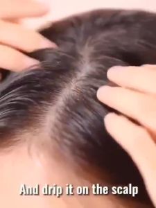 🔥Best Ginger Hair Growth Shampoo🔥Ginger Shampoo▲Anti-hair loss▲Promoting hair growth▲Oil control▲Strength▲Hair growth fast▲250ml▲Promoting hair growth▲Reducing hair loss▲Anti-dandruff and anti-itching▲Repairing dry and frizz▲Herbal Care