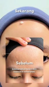 Nourri Skin Essence Advanced Moisturizer - For Optimum Skin Wellness Eczema and Psoriasis