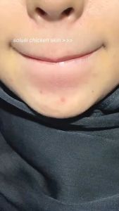 Glad2glow❤️ Peeling Serum - Glad2glow Glad2Glow AHA BHA PHA Intensive Peeling Solution 15ml