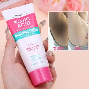 SADOER | Kem Làm Trắng Vùng Kín Serum Làm Trắng Nách Kem Làm Sáng Mông Đầu Gối Loại Bỏ Melanin Làm Sáng Da Cho Nam & Nữ