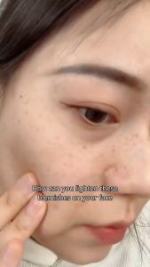 Kem humUi tan rã sắc tố 20g Chứa Nicotinamide Giúp Làm Trắng Xóa Nếp Nhăn Dưỡng Ẩm Và Xóa