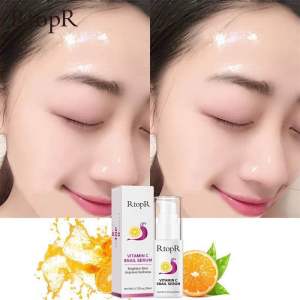 RTOPR VITAMIN C SNAIL SERUM penghalus kulit menghilangkan bintik hitam merah kulit skin glowing