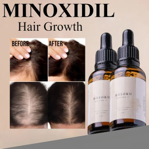 Hair Growth(with collagen and castor oil) Minoxidil 15% Hair Grower Hair Growth serum