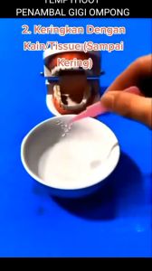 SWS 250 BUTIR TEMPTOOTH PENAMBAL GIGI BERLUBANG TEMPTOOTH