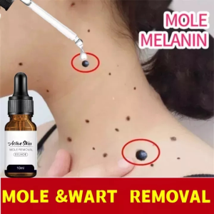 【EELHOE】 Wart Removal Serum Krim Penghilang Lalat Krim Penghilang Kutil Mudah Dibawa Untuk Semua Kulit Krim Penghilang Kutil