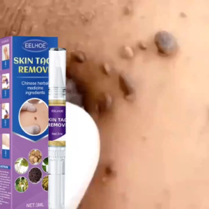 Warts remover original watson warts removal kasoy oil warts remover legit kulugo remover original warts and skin tag remover