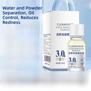 Salicylic Acid Acne Treatment Essence Oil Control Pore Minimizing Student Acne Scar Fading Spot Treatment Liquid Serum