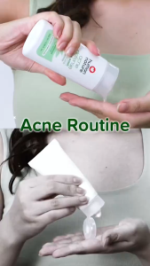 Human Nature Acne Defense Facial Wash with TeaTree + Cica + Niacinamide 100ml - pH balanced for Acne-Prone Skin | Oil Control Pimple- Fighting Soothing (No Harmful Chemicals)