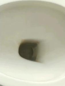 《店铺新品》💗🙋‍♀️💗【93%好评率】尿碱融通剂强力去除马桶尿碱垢溶解顽固污渍疏通剂厕所卫生间清洁