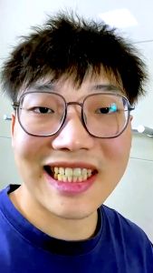 Pasta Pemutih Gigi Charcoal: Solusi Bau Mulut & Noda Gigi