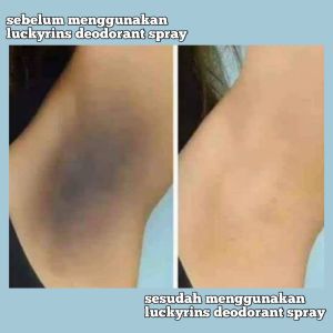 PENGHARUM KETIAK PEMBERSIH KETIAK PALING LARIS