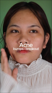 OMG Oh My Girl Salicylic Acid + Aloe Vera Acne Clear Serum Acne Care