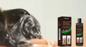 【Hot Sale】Eelhoe Tinea Capitis Antipruritic Shampoo – Anti Hair Loss & Oil Control Removes Dandruff Controls Itching Refreshing Scalp Care (100ml) | In Stock | Fast Shipping